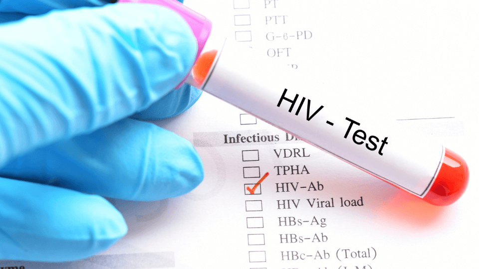 10 Early Signs of HIV