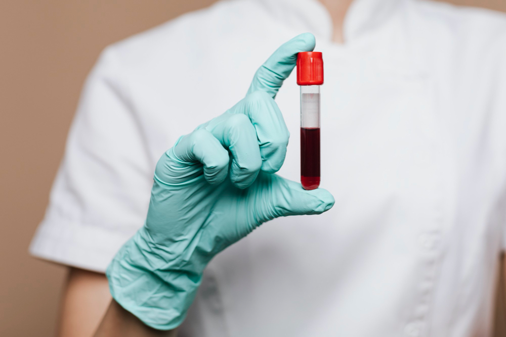 What Does It Mean If Your MCV Blood Test Is High Personalabs