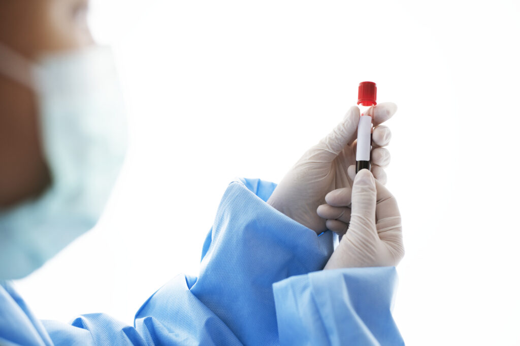 Doctor holding a blood test tube