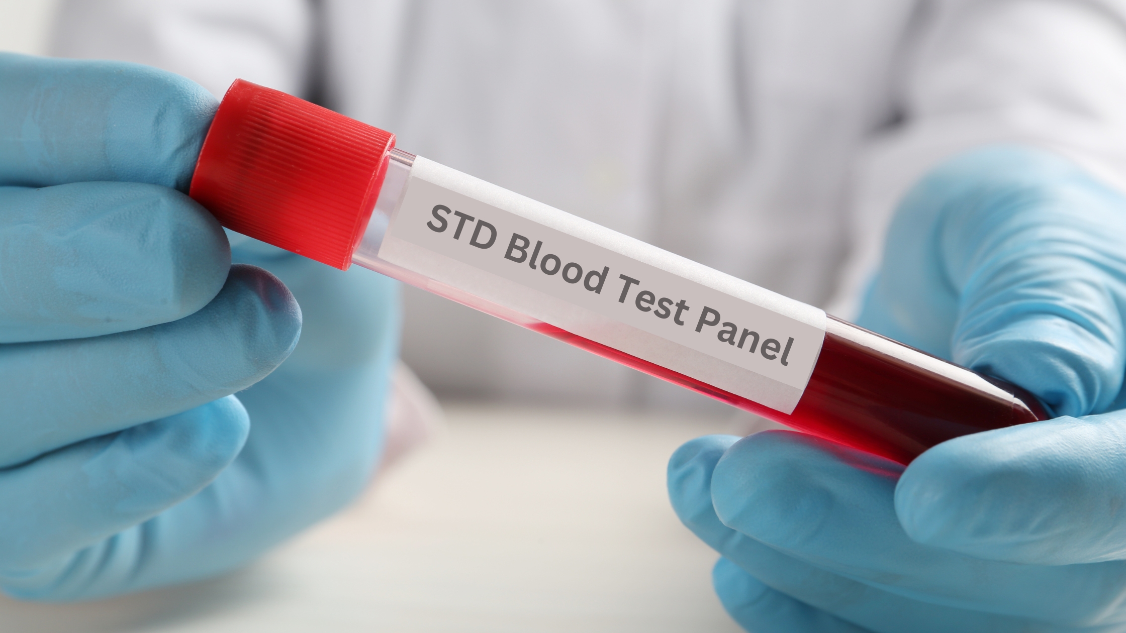 blood sample collected for a full STD panel