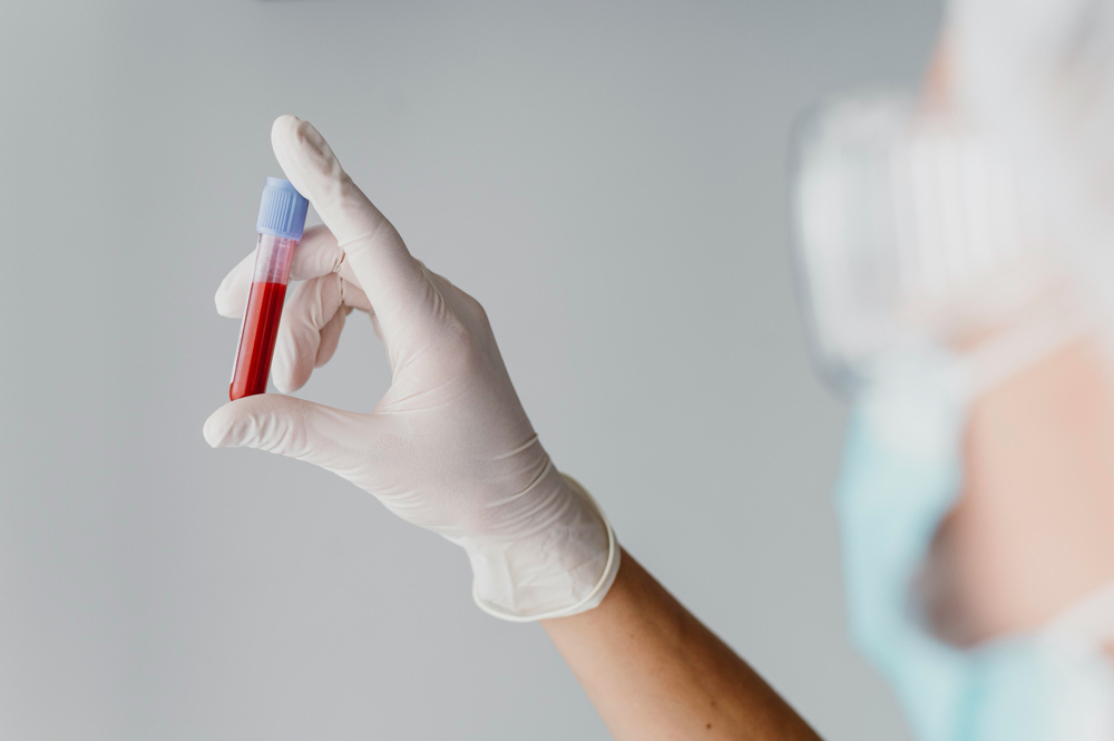 Back view doctor holding a blood sample