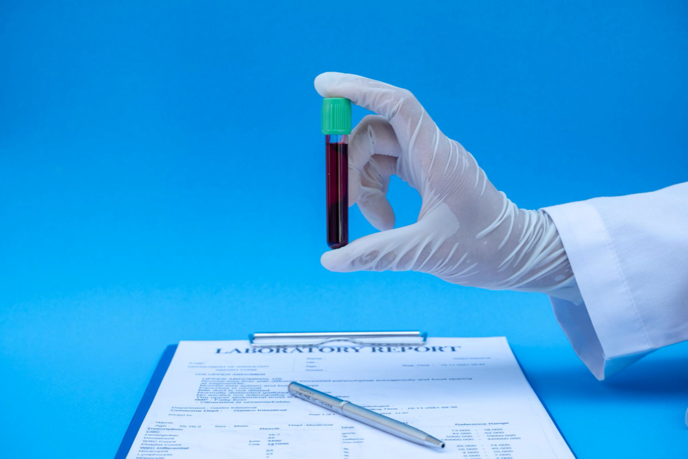 person holding blood test over lab results