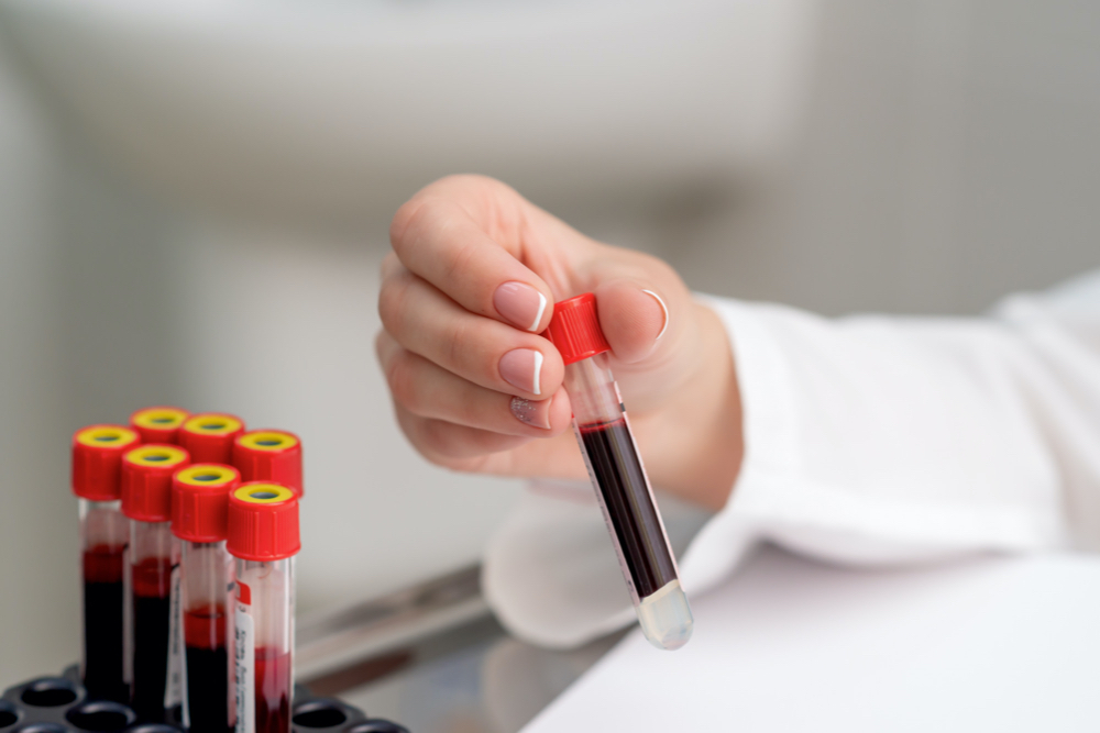 Test tube with blood in hand.